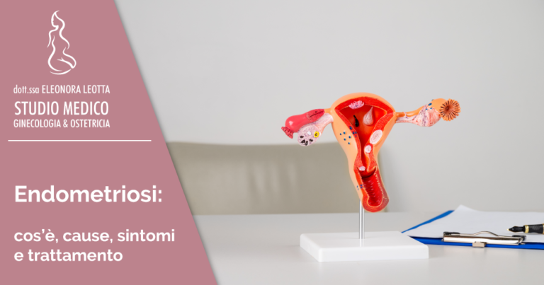 Endometriosi: cos’è, sintomi, cause e cura